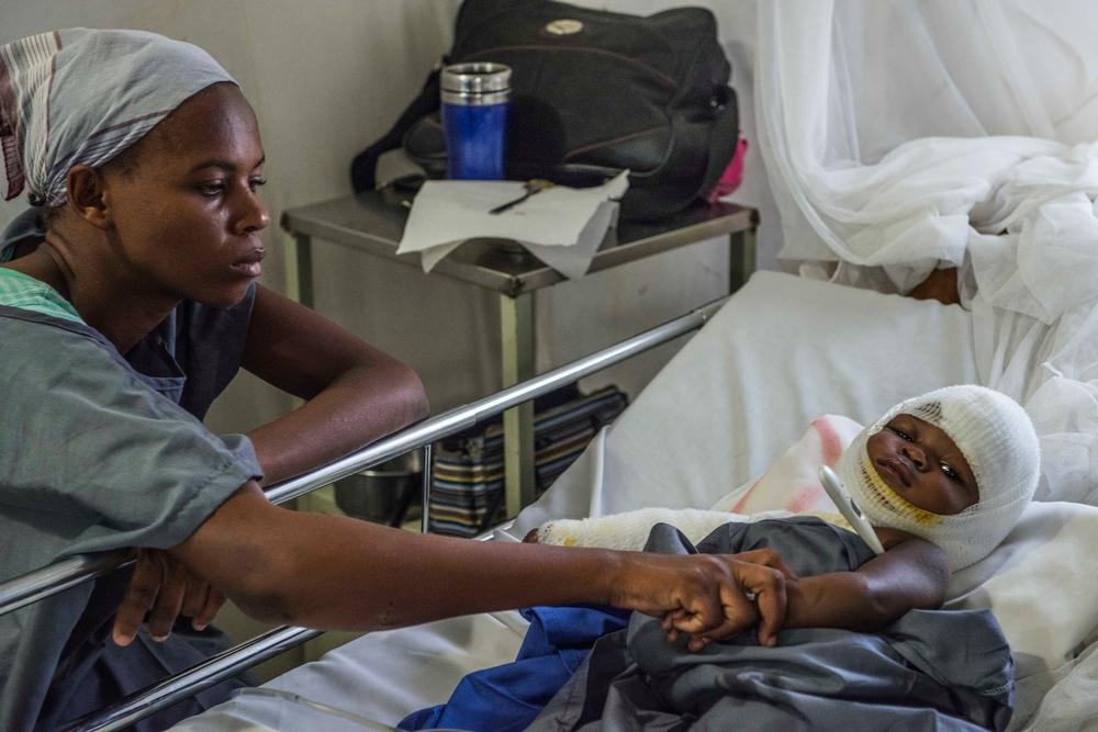 Severe burn victims in MSF Drouillard hospital. Photo:Yann Libessart/MSF