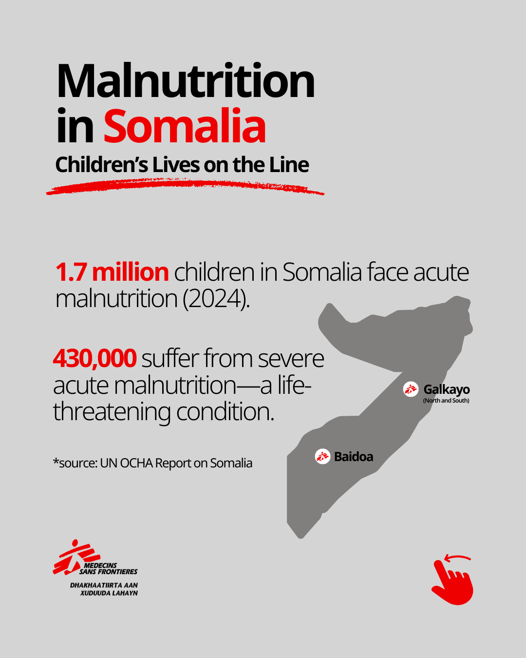 Malnutrition in Somalia 2024