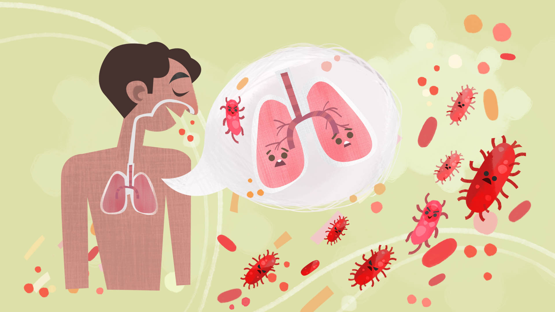Is tuberculosis similar to pneumonia?