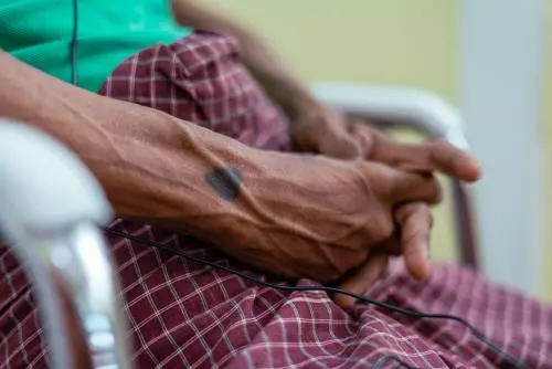 Doctors Without Borders: pastikan akses tanpa hambatan ke perawatan kesehatan di Myanmar