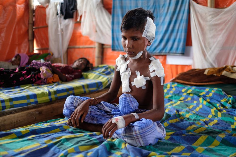 An injured Rohingya boy sits on his bed at MSF's medical facility in Kutupalon