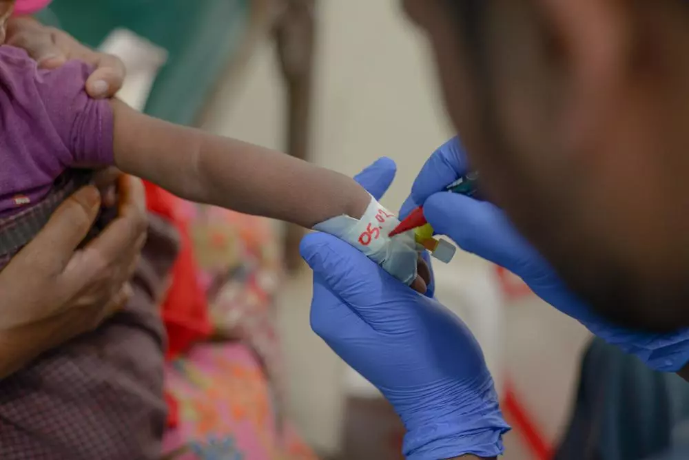 Measles patient story
