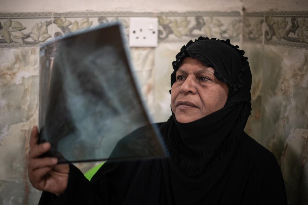 Hameeda, 65, photographed in her home, is Iraq’s first patient to be cured with the new oral treatment for multidrug-resistant tuberculosis. Before starting this treatment, she was having daily painful injections that had the potential of causing serious side effects; like hearing loss and kidney damage.