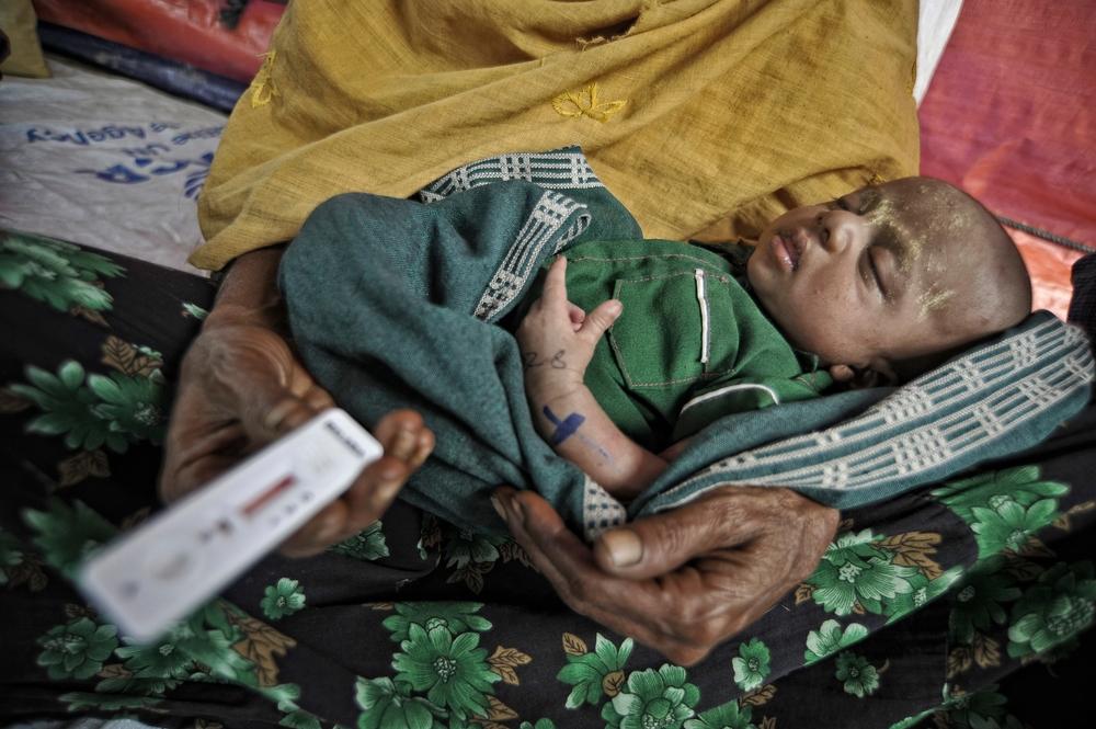 A sick child sleeps in his mother's arms while waiting for the malaria screening test result at MSF clinic in a refugee camp on the outskirts of Pauk Taw township, February 3, 2013. photo by Kaung Htet