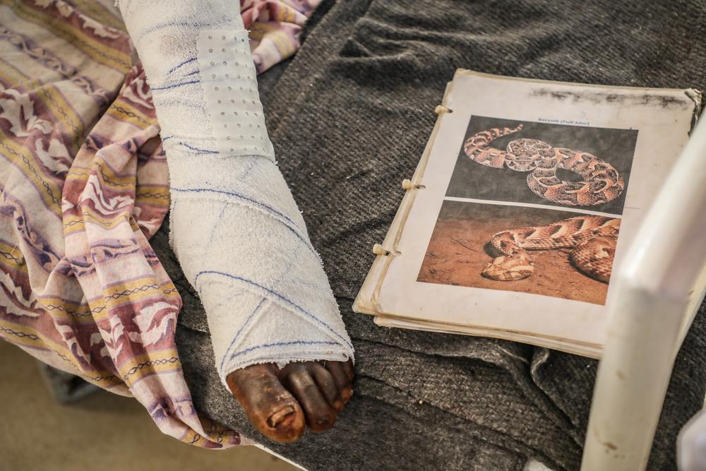 an MSF patient's foot next to picture of venomous snake in South Sudan. © Fanny Hostettler 