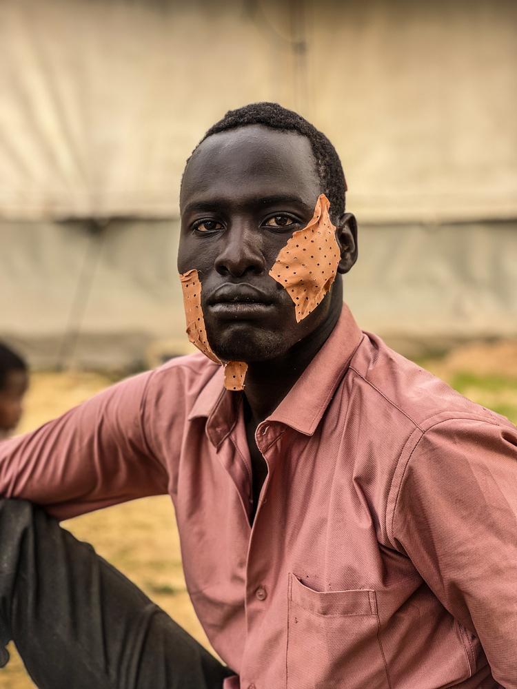 Nour escaped the war in El Geneina, Sudan, with wounds to his face. Upon reaching Adré in Chad, near the border with Sudan, MSF teams provided him, and hundreds of other war-wounded, with medical care. Adré, Chad, June 2023. © Mohammad Ghannam/MSF