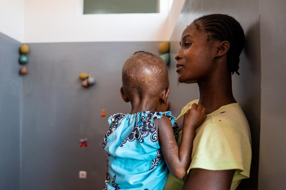 Paulina Cassombu holds her daughter, Rosa, who had been admitted to Cuvango Municipal hospital three weeks earlier with severe malnutrition and a loss of mobility. MSF staff were able to treat her malnutrition and get her walking again. Cuvango, Huíla province, Angola, May 2023. © Mariana Abdalla/MSF