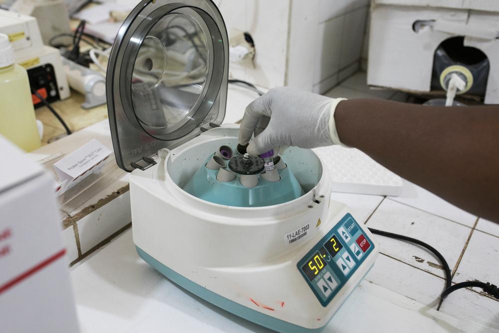 Blood samples in the MSF-supported laboratory await the addition of reagent before being tested for viral load levels using the Bio Centric machine. Guinea, 2018. © Albert Masias/MSF 