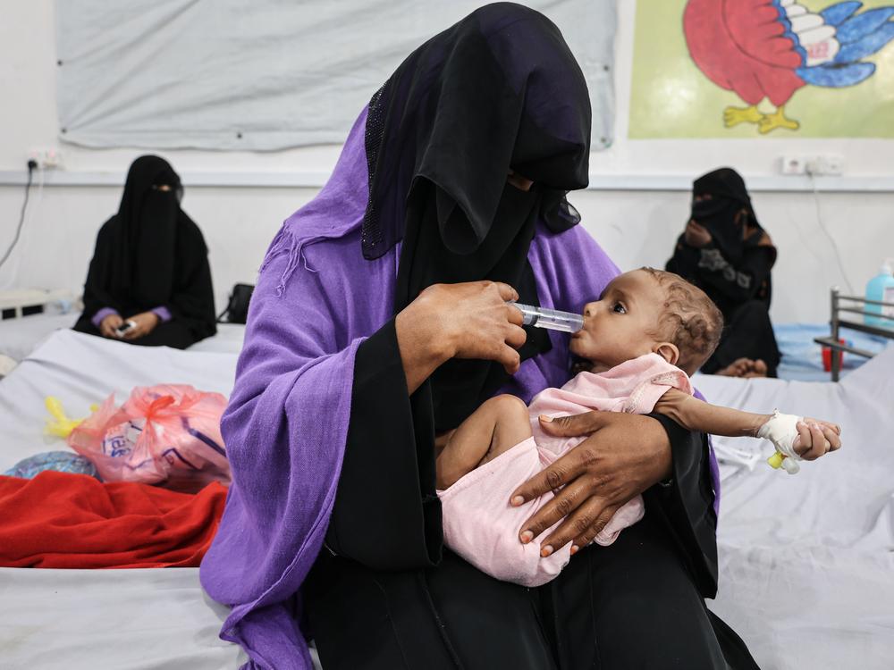A mother feeds her nine-month-old son who was admitted to the Doctors Without Borders-supported inpatient therapeutic feeding center at Abs general hospital, Hajjah governorate, Yemen.