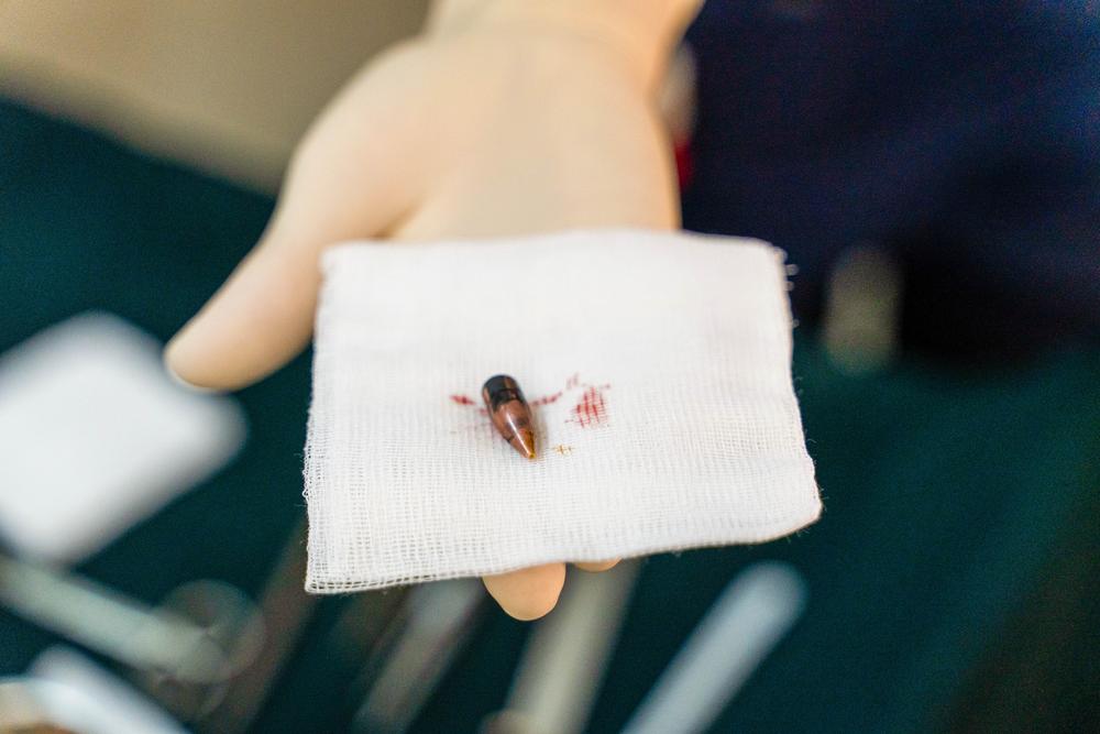 Emergency Surgical Team at Bashair Hospital Khartoum. A bullet extracted from a patient. Bullet wounds are one of the most common cases treated at Bashair hospital on a daily basis. Sudan, May 2023. © Ala Kheir/MSF