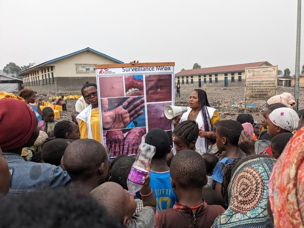 Doctors Without Borders health promoters teams are conducting health promotion session to raise awareness of Mpox epidemic. DRC, May 2023. © MSF