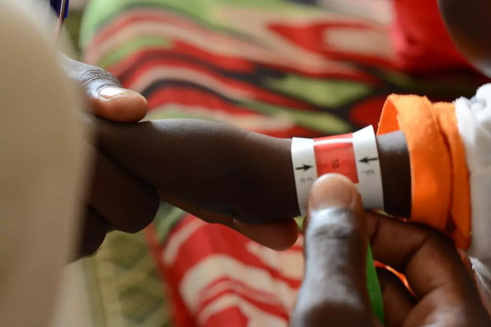 Malnutrition among children. A child undergoes a MUAC screening in the ATFC at the MSF clinic in Zamzam Camp, North Darfur