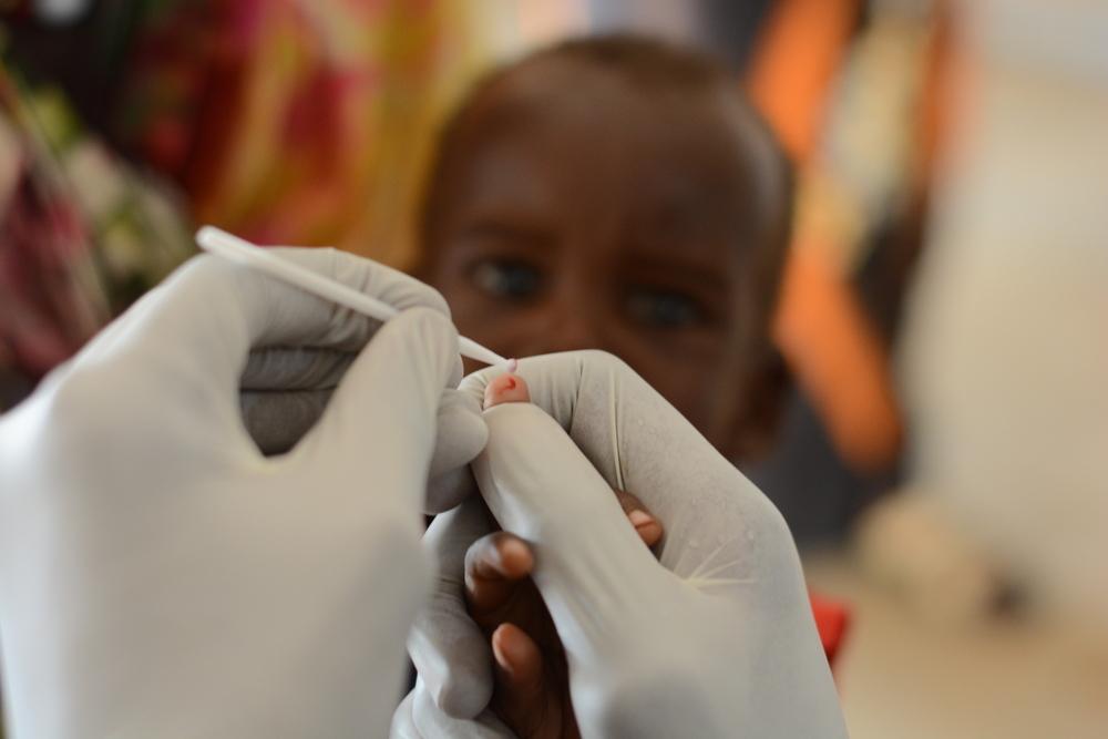 A malaria checkup is conducted on a child in the ER department at the MSF clinic in Zamzam Camp, North Darfur