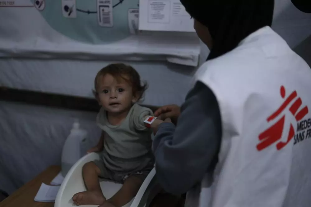 An MSF nurse measures the mid-upper arm circumference of one-year-old child, who has suffered from severe acute malnutrition since birth.