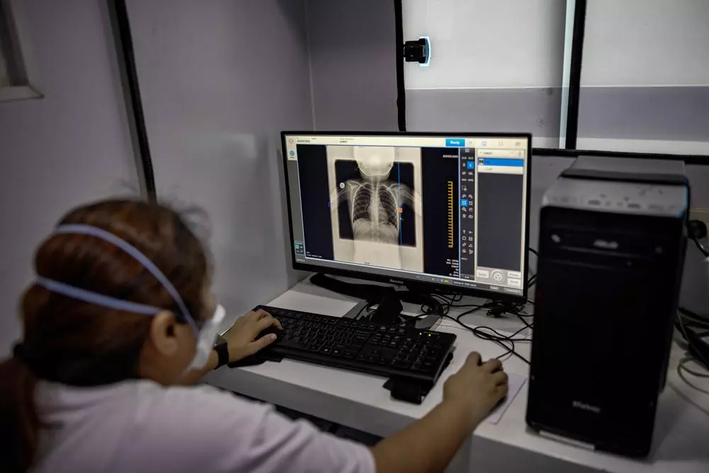 MSF staff looking at x-ray