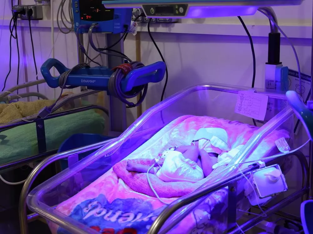 A newborn baby in the neonatal intensive care unit in hospital.