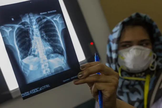 Deadly Gaps: Don't turn away from saving lives