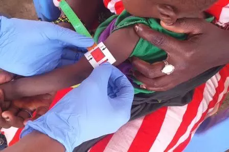 Somalia: Lima fakta mengenai kemarau, kekurangan zat makanan dan wabak penyakit di Baidoa