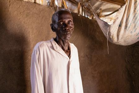 Sudan Selatan: Bagaimana malnutrisi berdampak buruk pada pandemi TB/HIV