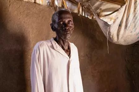 South Sudan: Paano pinalalala ng malnutrisyon ang pandemya ng TB/HIV 