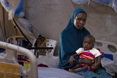 尼日利亚北部 ： 严重营养不良入院儿童创下高，医疗机构不堪重负