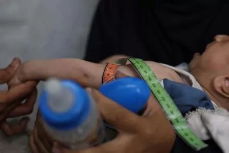 Gaza: Isa sa bawat apat na bata at mga nagdadalang taong kababaihan na nagpupunta sa mga klinika ng Doctors Without Borders ay malnourished